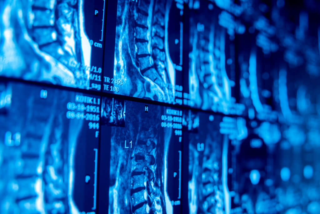 Diagnostic imaging referrals for pedestrian accident injuries